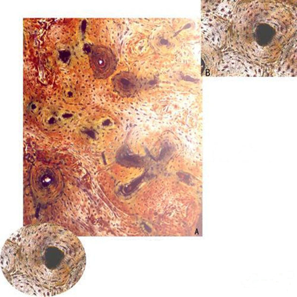 Hard Bone Ground Section, c.s. Microscope Slide - Dr Wong Anatomy