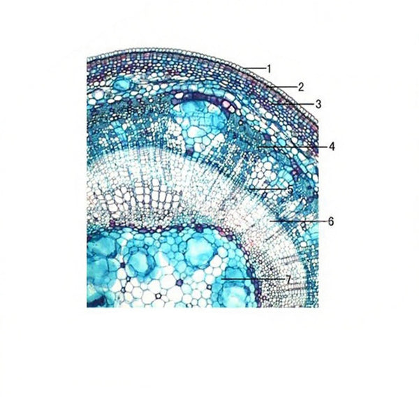 Linden One-Year-Old Stem, c.s. Prepared Microscope Slide - Dr Wong Anatomy