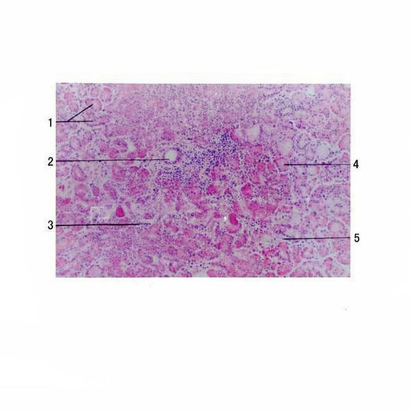 Lacrimal Gland, Microscope Slide - Dr Wong Anatomy