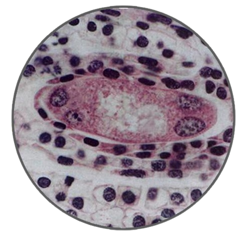 Lily Ovary, Young Embryo Sac Stage, Prepared Microscope Slide - Dr Wong Anatomy