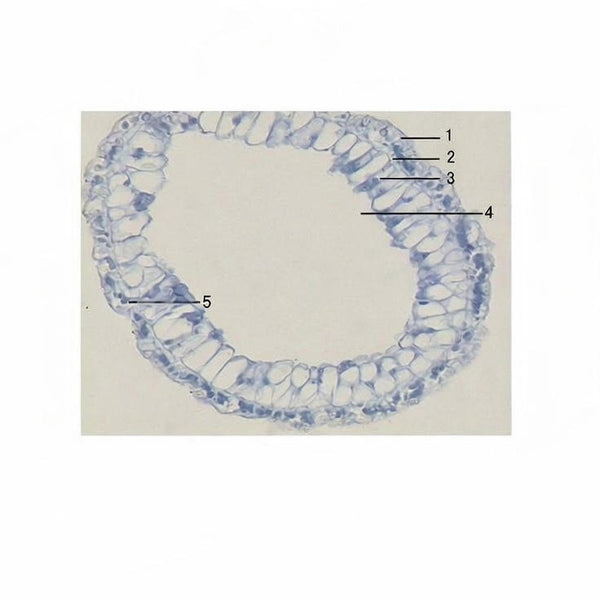 Hydra, c.s. Prepared Microscope Slide