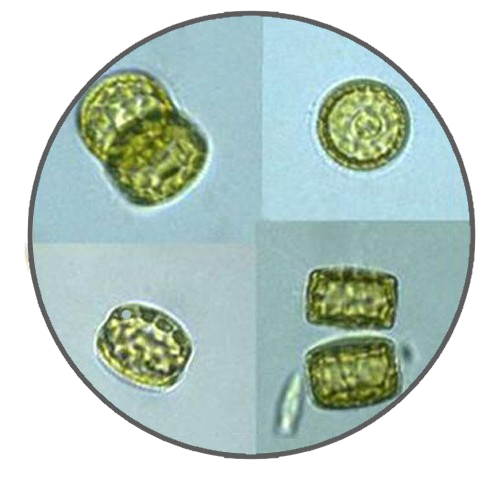 Cyclotella, Prepared Microscope Slide