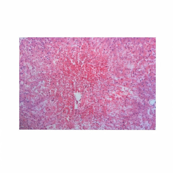 Chronic Hepatic Congestion, Microscope Slide - Dr Wong Anatomy