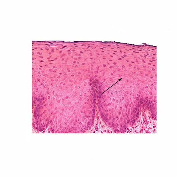 Stratified Squamous Epithelium, Microscope Slide - Dr Wong Anatomy