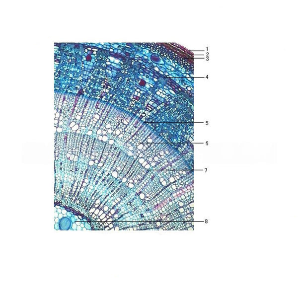 Linden Three-Year-Old Stem, c.s. Prepared Microscope Slide - Dr Wong Anatomy