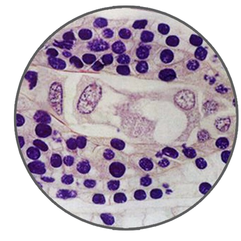 Lily Ovary, Mature Embryo Sac Stage, Prepared Microscope Slide - Dr Wong Anatomy