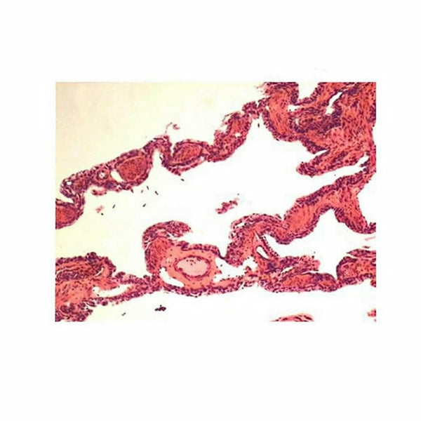 Frog Lung (Portion), Microscope Slide - Dr Wong Anatomy