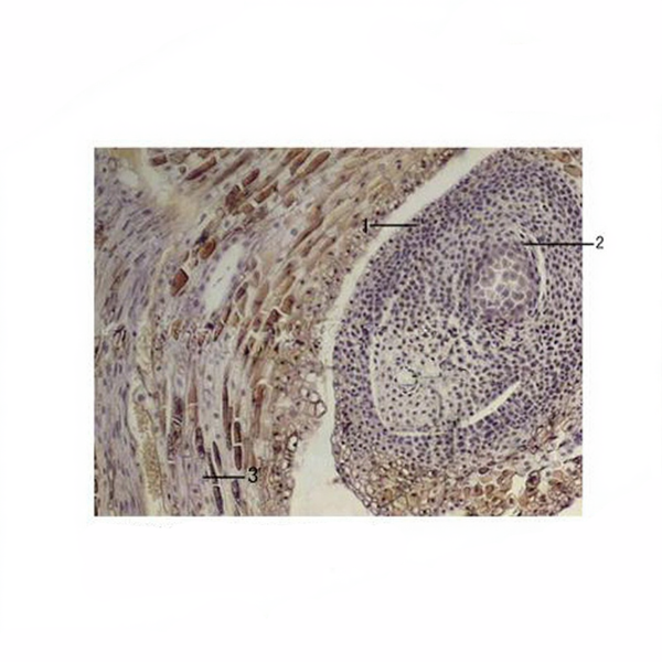 Pine Female Cone, l.s. Prepared Microscope Slide - Dr Wong Anatomy