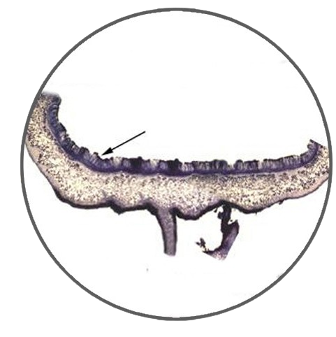 Lichen Apothecium, Prepared Microscope Slide