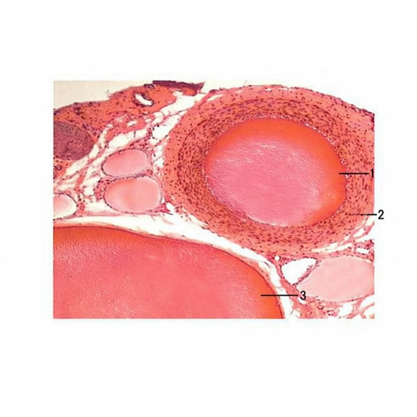 Artery and Vein with Nerve, c.s. Microscope Slide - Dr Wong Anatomy