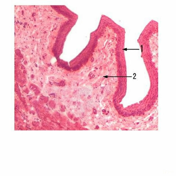 Ox Ureter, c.s. Microscope Slide - Dr Wong Anatomy
