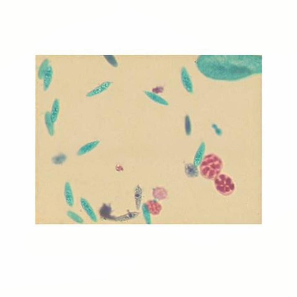 Plankton (Phytoplankton and Zooplankton), Microscope Slide - Dr Wong Anatomy