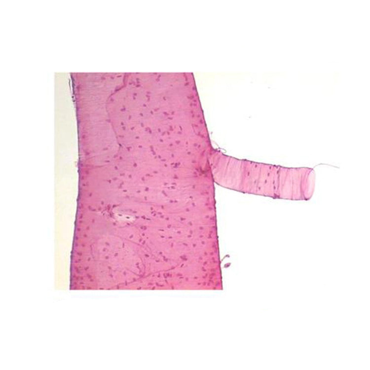 Locust Trachea, Microscope Slide - Dr Wong Anatomy