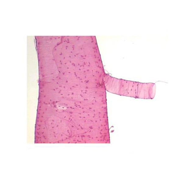 Locust Trachea, Microscope Slide - Dr Wong Anatomy