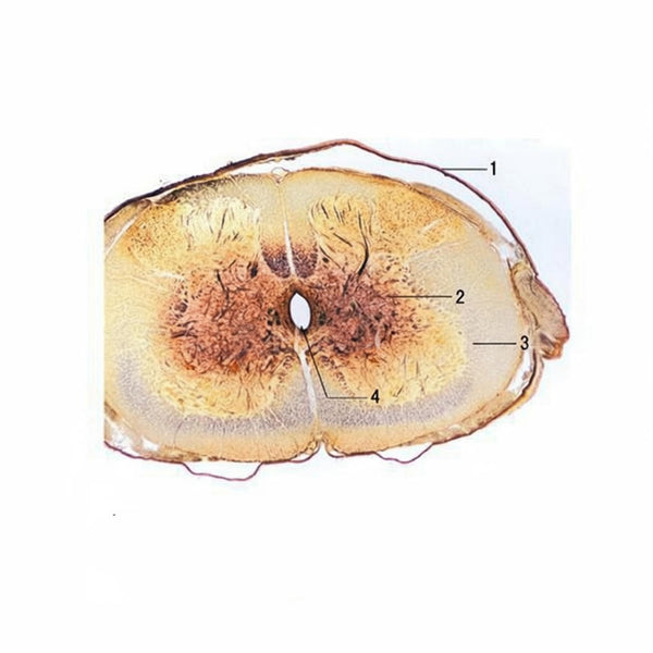 Spinal Cord, c.s. Microscope Slide - Dr Wong Anatomy