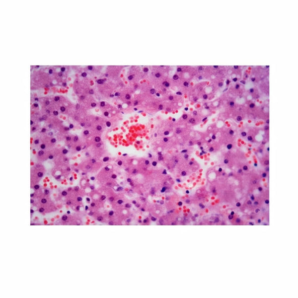 Liver Fatty Degeneration, Microscope Slide - Dr Wong Anatomy
