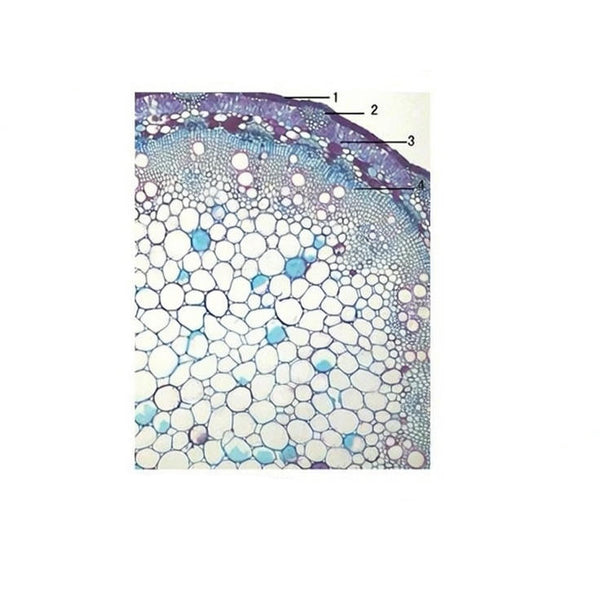Knotweed Stem, c.s. Prepared Microscope Slide - Dr Wong Anatomy