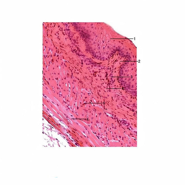 Esophagus, c.s. Microscope Slide - Dr Wong Anatomy