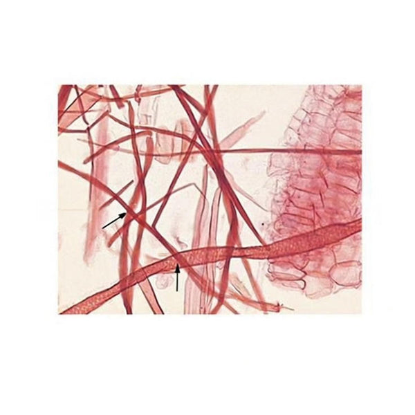 Linden Lenticel, Prepared Microscope Slide - Dr Wong Anatomy
