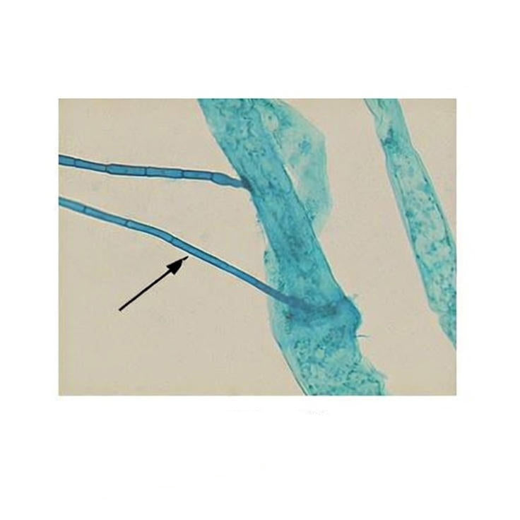 Cladophora, Prepared Microscope Slide
