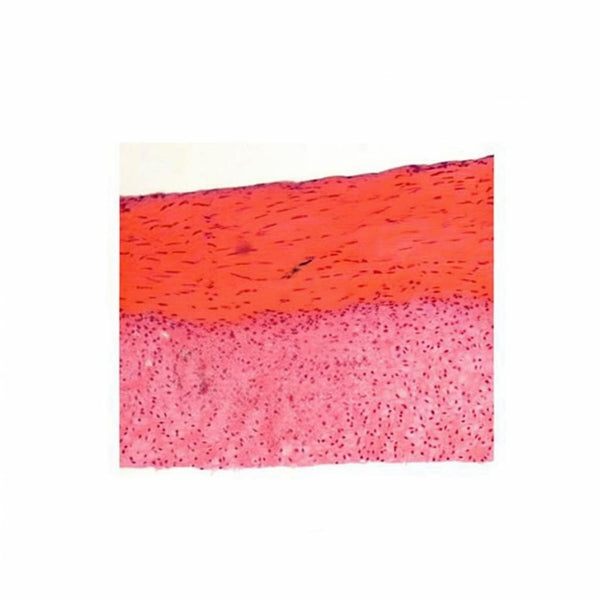 Dense Connective Tissue, Microscope Slide - Dr Wong Anatomy