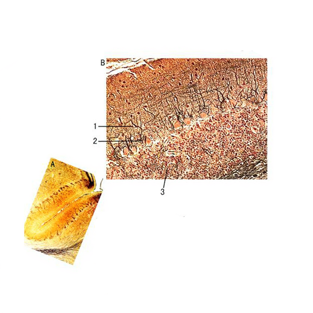 Purkinje Cells of Cerebellum, Microscope Slide - Dr Wong Anatomy