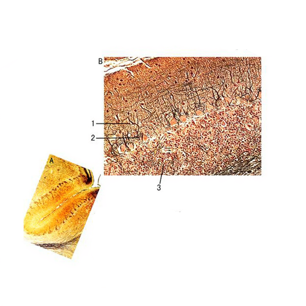 Purkinje Cells of Cerebellum, Microscope Slide - Dr Wong Anatomy