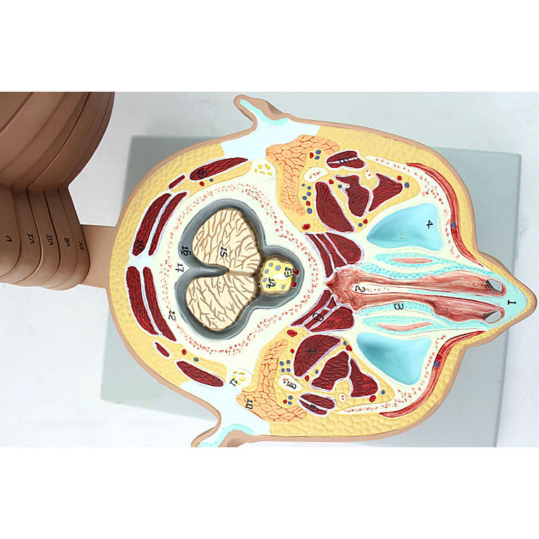 Anatomical Section of Head Model – Dr Wong Anatomy