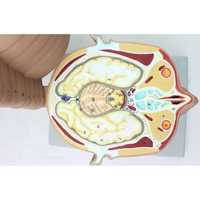Anatomical Section of Head Model – Dr Wong Anatomy