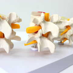 Degenerative Lumbar Vertebrae Disk Disease