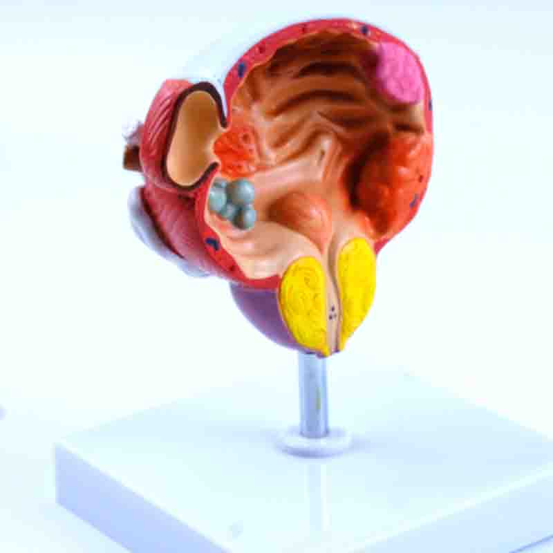 Prostate Scale Modle Diseases of Bladder and Prostate Model – Dr Wong Anatomy