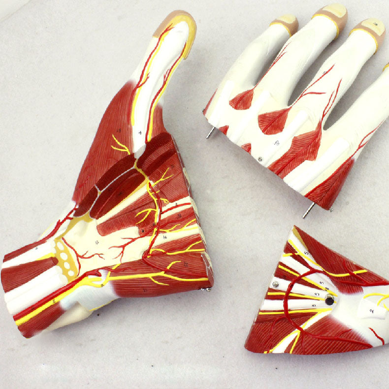 Hand Anatomy Model, 2X Life-Size, 3 Parts