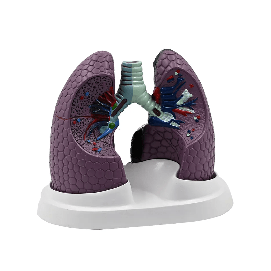 Lung Set Model with Pathologies – Dr Wong Anatomy