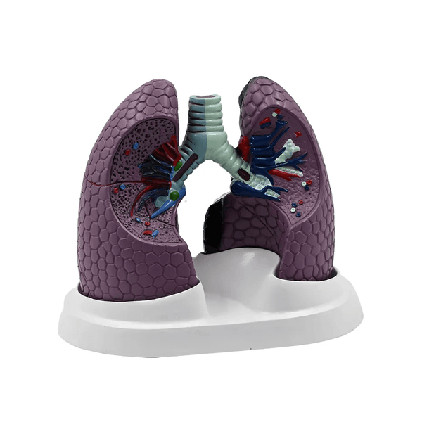 Lung Set Model with Pathologies