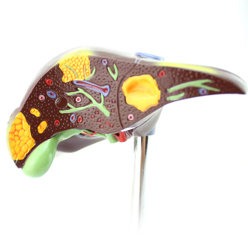Liver Diseases Model，1/3 Life-Size, 2 Parts – Dr Wong Anatomy