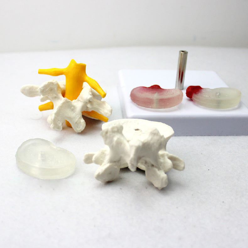 Lumbar Vertebrae Model with Interchangeable Discs – Dr Wong Anatomy
