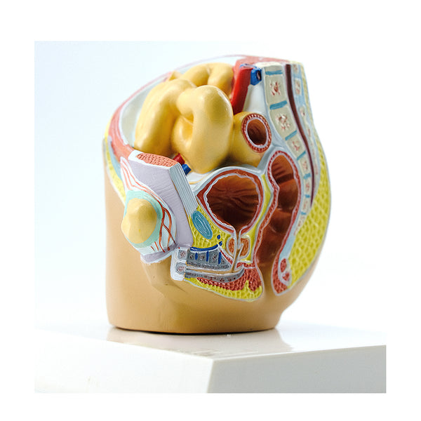 Indirect Inguinal Hernia Model