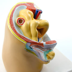 Indirect Inguinal Hernia Model