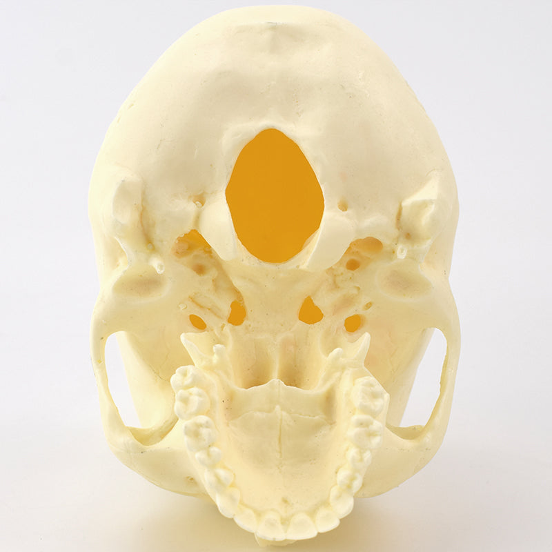 Advanced Skull Model for Surgical Training