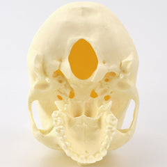 Advanced Skull Model for Surgical Training