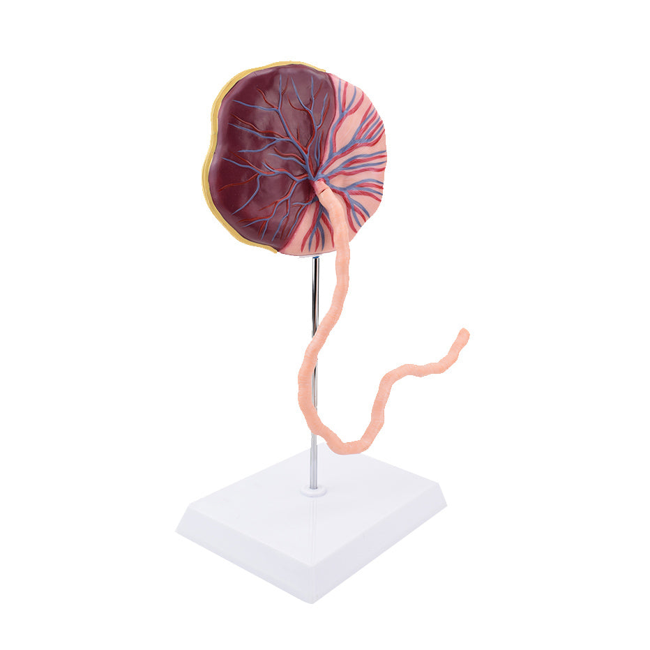 Placenta Model with Removable Umbilical Cord