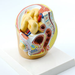 Indirect Inguinal Hernia Model