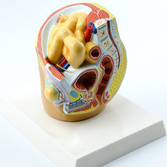 Indirect Inguinal Hernia Model