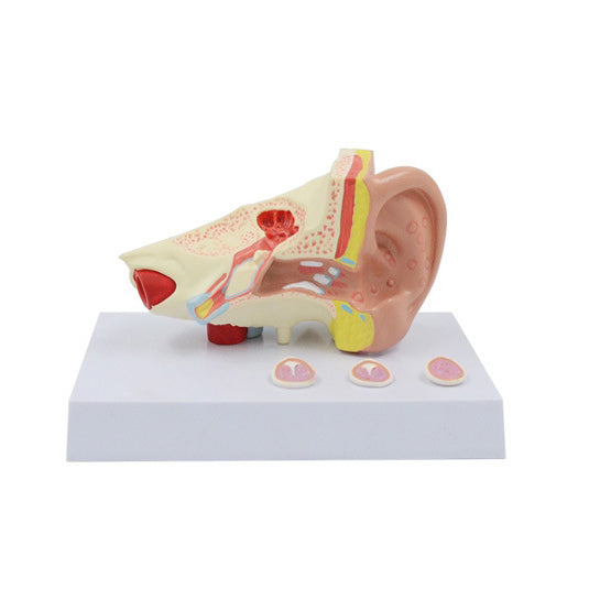 Pathological Model of Common Ear Diseases, 1.5X Life-Size