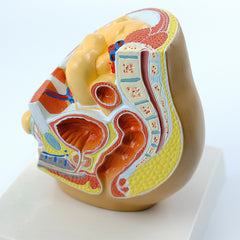 Indirect Inguinal Hernia Model