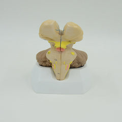 Brainstem, Cerebellum, & Fourth Ventricle Model, 3 Parts