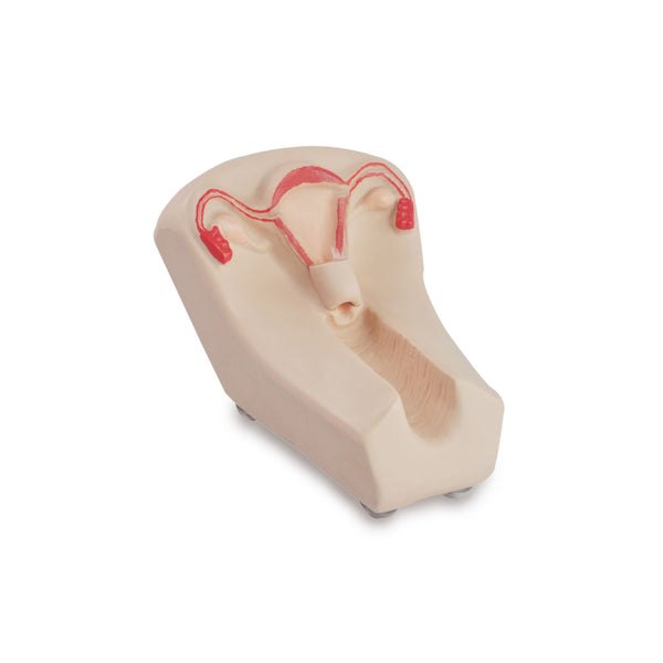 Intrauterine Device (IUD) Training Model
