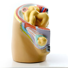 Indirect Inguinal Hernia Model