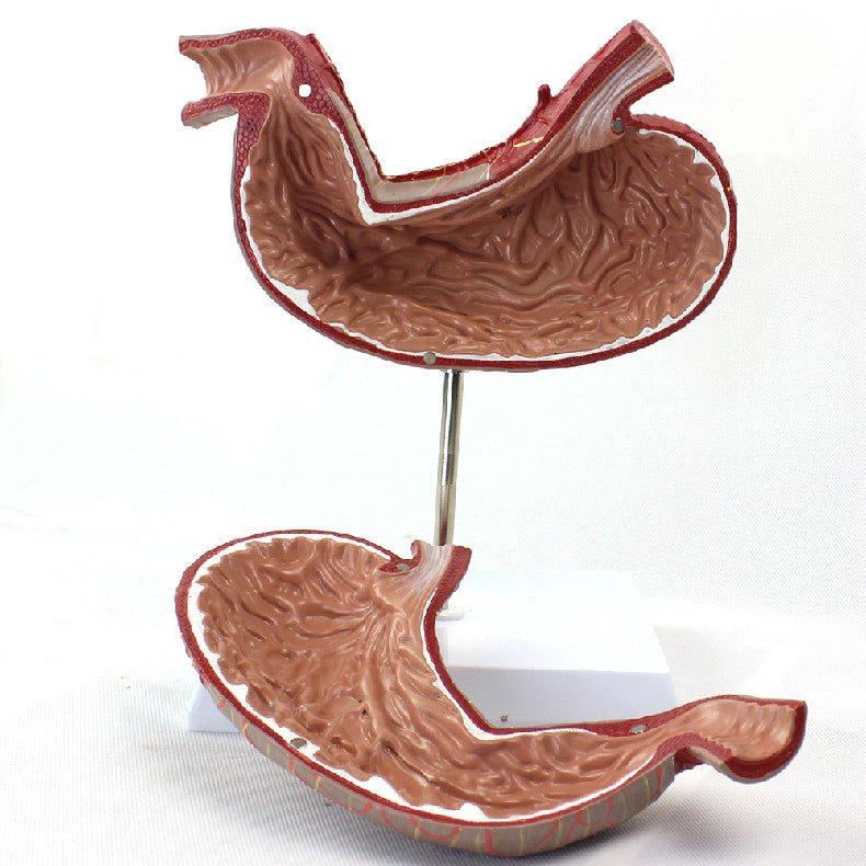 Stomach Model, 1.5X Life-Size，2 Parts