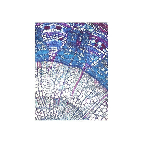 Linden Biennial Stem, c.s. Prepared Microscope Slide - Dr Wong Anatomy